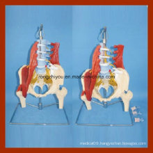 Pathological Model Disc Natural Size Lumbar with The Pelvis and Half Leg Model